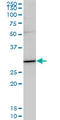 TNFRSF1A Associated Via Death Domain antibody, LS-C139379, Lifespan Biosciences, Western Blot image 