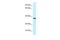 Proline-Serine-Threonine Phosphatase Interacting Protein 2 antibody, A11056, Boster Biological Technology, Western Blot image 