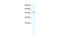 DMRT Like Family B With Proline Rich C-Terminal 1 antibody, 28-428, ProSci, Enzyme Linked Immunosorbent Assay image 