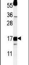 Dap12 antibody, PA5-26861, Invitrogen Antibodies, Western Blot image 