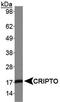 Teratocarcinoma-Derived Growth Factor 1 antibody, TA301467, Origene, Western Blot image 
