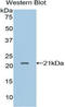 Leukocyte Cell Derived Chemotaxin 2 antibody, LS-C295148, Lifespan Biosciences, Western Blot image 