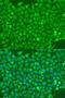 Fms Related Tyrosine Kinase 4 antibody, 19-753, ProSci, Immunofluorescence image 