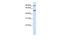 WD Repeat Domain 34 antibody, GTX46236, GeneTex, Western Blot image 