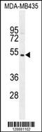 GDNF Family Receptor Alpha Like antibody, 55-602, ProSci, Western Blot image 