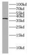 GDNF Family Receptor Alpha 2 antibody, FNab03438, FineTest, Western Blot image 