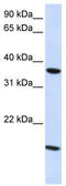 CLD16 antibody, TA334205, Origene, Western Blot image 