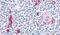 CD49D antibody, PA5-32882, Invitrogen Antibodies, Immunohistochemistry frozen image 