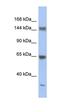 Ataxin 2 antibody, orb329972, Biorbyt, Western Blot image 
