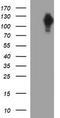 Neurofilament Medium antibody, LS-C338179, Lifespan Biosciences, Western Blot image 