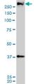 Cullin-9 antibody, H00023113-M01, Novus Biologicals, Western Blot image 