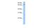 La Ribonucleoprotein Domain Family Member 7 antibody, GTX47301, GeneTex, Western Blot image 