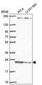 Transmembrane P24 Trafficking Protein 3 antibody, PA5-67440, Invitrogen Antibodies, Western Blot image 