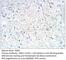 PMS1 Homolog 2, Mismatch Repair System Component antibody, PMS2-212AP, FabGennix, Immunohistochemistry paraffin image 