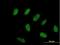 Zinc Finger Protein 776 antibody, H00284309-B01P, Novus Biologicals, Immunofluorescence image 