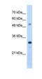 Proteasome Activator Subunit 3 antibody, orb330470, Biorbyt, Western Blot image 