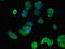 Mitogen-Activated Protein Kinase Kinase 4 antibody, CSB-PA013413LA01HU, Cusabio, Immunofluorescence image 