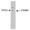 Cytochrome P450 Family 2 Subfamily R Member 1 antibody, NBP2-50204, Novus Biologicals, Western Blot image 