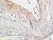 ADAM Metallopeptidase With Thrombospondin Type 1 Motif 7 antibody, orb10042, Biorbyt, Immunohistochemistry paraffin image 