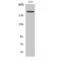 DNA Topoisomerase II Alpha antibody, LS-C386481, Lifespan Biosciences, Western Blot image 