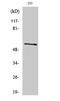 ATP Synthase F1 Subunit Alpha antibody, A03598, Boster Biological Technology, Western Blot image 