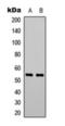 Phosphatase And Tensin Homolog antibody, orb393139, Biorbyt, Western Blot image 