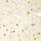 Hypoxia Inducible Factor 1 Subunit Alpha Inhibitor antibody, LS-C334077, Lifespan Biosciences, Immunohistochemistry paraffin image 