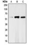 Checkpoint Kinase 1 antibody, MBS821439, MyBioSource, Western Blot image 