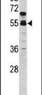 Coagulation Factor X antibody, PA5-13688, Invitrogen Antibodies, Western Blot image 