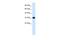 Chromosome 22 Open Reading Frame 31 antibody, A18310, Boster Biological Technology, Western Blot image 