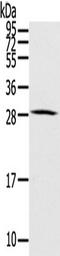 Homeobox protein Hox-C8 antibody, TA322194, Origene, Western Blot image 