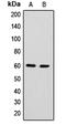 Heterogeneous Nuclear Ribonucleoprotein L Like antibody, LS-C354260, Lifespan Biosciences, Western Blot image 