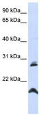Spermatogenesis Associated 9 antibody, TA339593, Origene, Western Blot image 