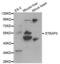 STEAP3 Metalloreductase antibody, abx000818, Abbexa, Western Blot image 
