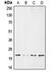 BCL2 Interacting Protein 3 antibody, LS-C351875, Lifespan Biosciences, Western Blot image 