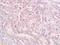 3-Phosphoinositide Dependent Protein Kinase 1 antibody, orb6678, Biorbyt, Immunohistochemistry paraffin image 