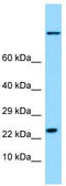 Heat Shock Protein Family B (Small) Member 9 antibody, TA331209, Origene, Western Blot image 