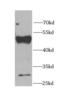Farnesyl-Diphosphate Farnesyltransferase 1 antibody, FNab03064, FineTest, Western Blot image 
