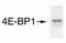 Mechanistic Target Of Rapamycin Kinase antibody, ab2732, Abcam, Immunoprecipitation image 