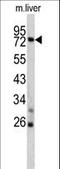 TNF Alpha Induced Protein 2 antibody, LS-C98711, Lifespan Biosciences, Western Blot image 