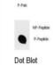 Inhibitor Of Nuclear Factor Kappa B Kinase Subunit Beta antibody, abx032155, Abbexa, Dot Blot image 