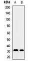 Glycine N-Methyltransferase antibody, LS-C667822, Lifespan Biosciences, Western Blot image 