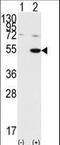 Glycogen Synthase Kinase 3 Alpha antibody, LS-B10711, Lifespan Biosciences, Western Blot image 