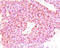 CHGA antibody, AM33329PU-T, Origene, Immunohistochemistry paraffin image 