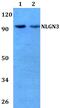 Neuroligin 3 antibody, PA5-75794, Invitrogen Antibodies, Western Blot image 