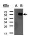 DLC1 Rho GTPase Activating Protein antibody, PA5-77867, Invitrogen Antibodies, Western Blot image 
