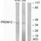 PR/SET Domain 12 antibody, A09645, Boster Biological Technology, Western Blot image 