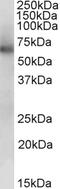 Aldehyde Dehydrogenase 1 Family Member B1 antibody, EB10122, Everest Biotech, Western Blot image 