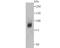 Decapping MRNA 1A antibody, A04587, Boster Biological Technology, Western Blot image 