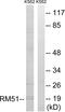 Mitochondrial Ribosomal Protein L51 antibody, LS-C119636, Lifespan Biosciences, Western Blot image 